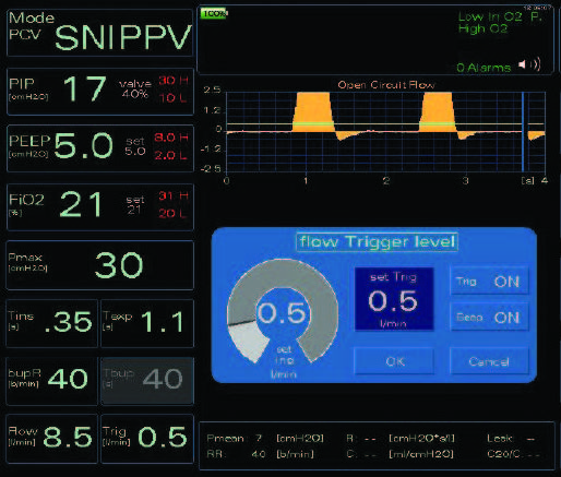 1. GIULIA_Neonatal Ventilator_en 1 1. GIULIA_Neonatal Ventilator_en 1