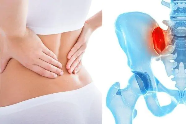 Ứng dụng liệu pháp năng lượng cao (HiTop) ở bệnh nhân mắc hội chứng đau vùng chậu mãn tính