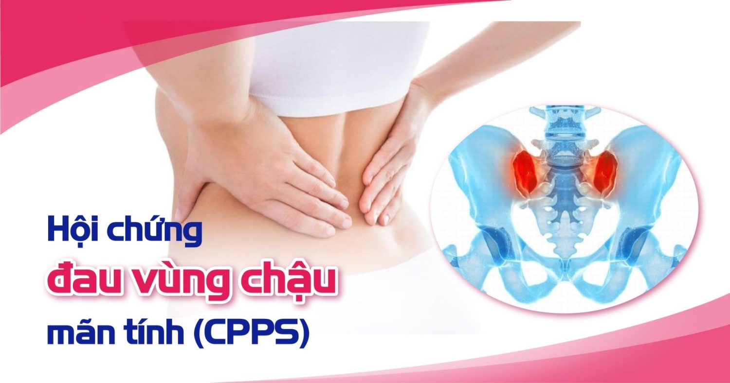 hoi_chung_dau_vung_chau_man_tinh_1b6e12cd40
