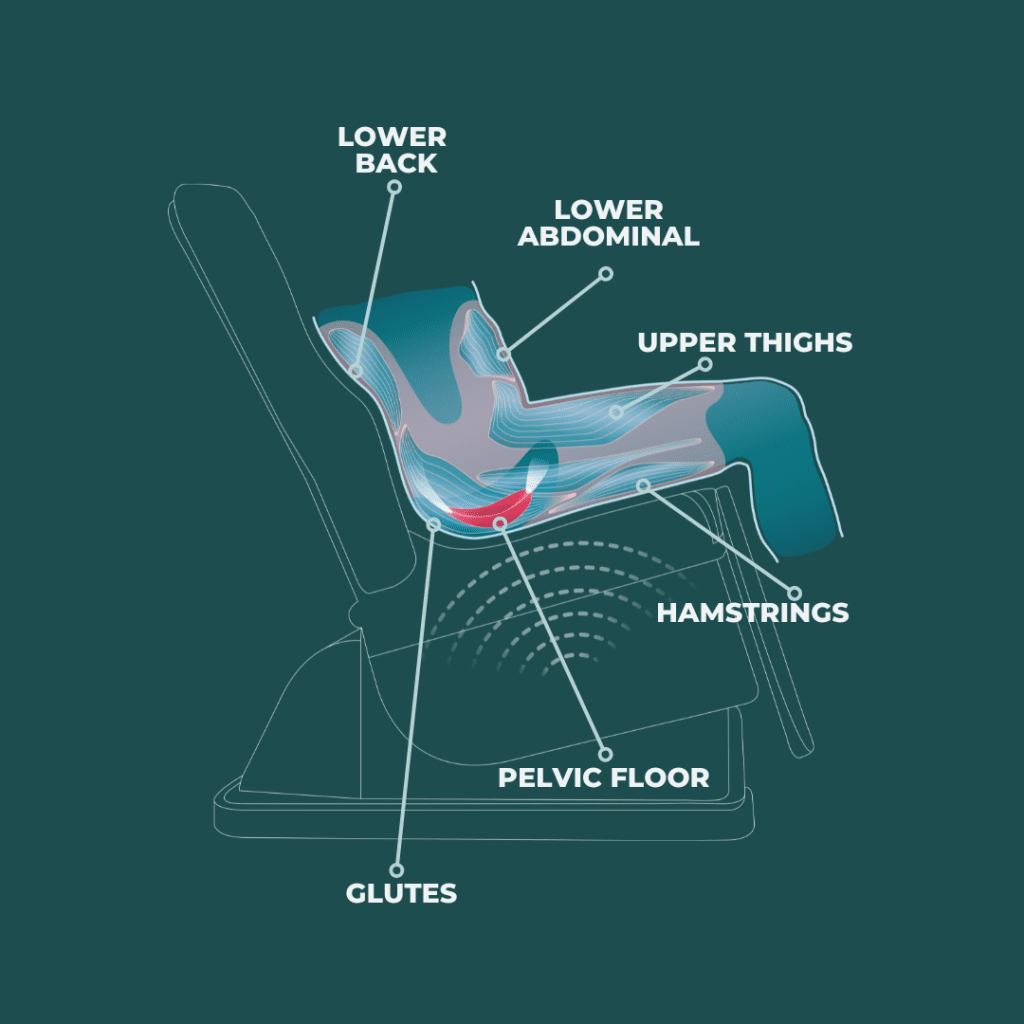 Phục hồi chức năng cơ sàn chậu với hệ thống Pelvic FMS hiện đại