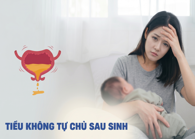 Tác động của liệu pháp từ trường ngoài cơ thể vùng sàn chậu kết hợp với luyện tập cơ sàn chậu (PFMT) đối với sức mạnh cơ sàn chậu và sa cơ quan vùng chậu ở bệnh nhân rối loạn chức năng cơ sàn chậu sau sinh